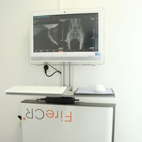 Digitální rentgen